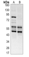 LKB1 Antibody