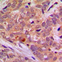 Anti-LKB1 Antibody