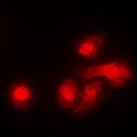 LKB1 antibody