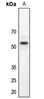 LKB1 Rabbit Polyclonal Antibody