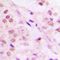 Anti-TCEB3 Antibody