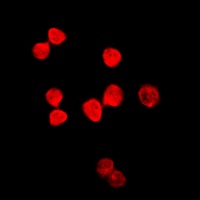 Thymine DNA Glycosylase Rabbit Polyclonal Antibody