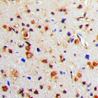 Anti-Tyrosine Hydroxylase (Phospho-S71) Antibody