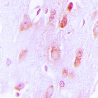 Anti-Tyrosine Hydroxylase Antibody