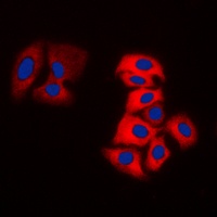 Anti-Tyrosine Hydroxylase Antibody