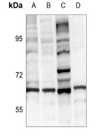 Tyrosine Hydroxylase Rabbit Polyclonal Antibody