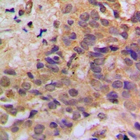 Anti-p53 (Phospho-S37) Antibody