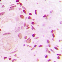 53BP1 Antibody