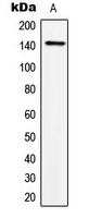 TRPS1 Rabbit Polyclonal Antibody