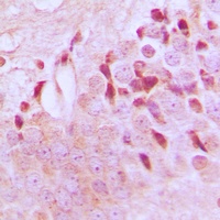 Anti-TSC2 (Phospho-T1462) Antibody