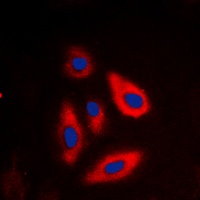 Anti-TSC2 (Phospho-T1462) Antibody