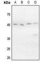 VASP (Phospho-S157) Antibody