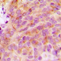 14-3-3 zeta Antibody