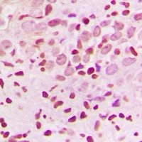 Anti-ZNF174 Antibody