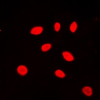 Anti-ZNF174 Antibody
