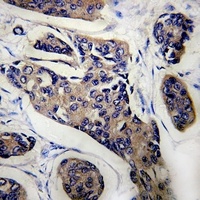 Anti-NCOA4 Antibody