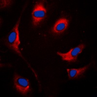 Anti-SOCS1 Antibody