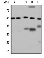 GALR2 Rabbit Polyclonal Antibody