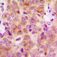 Anti-HGS Antibody