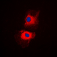 Anti-HGS Antibody