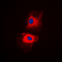 HGS antibody