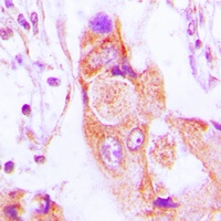 Anti-AIM2 Antibody