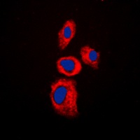 Anti-AIM2 Antibody