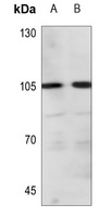 ADAMTS1 Rabbit Polyclonal Antibody