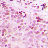 Anti-Separase (Phospho-S1126/801) Antibody