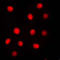Anti-Separase (Phospho-S1126/801) Antibody