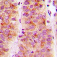 Anti-SLK Antibody