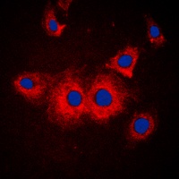 Anti-SLK Antibody