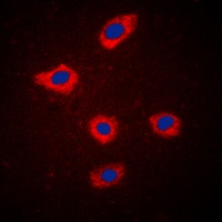 Anti-MELK Antibody