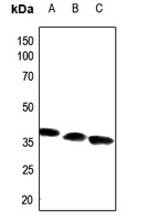 ACOT8 Antibody