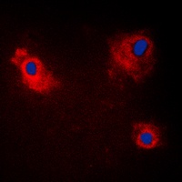 TANK antibody