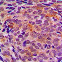 Anti-LYPLA1 Antibody