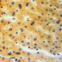 Anti-CRMP3 Antibody