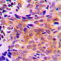 Anti-ACOT2 Antibody