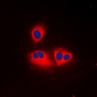 ACOT2 antibody