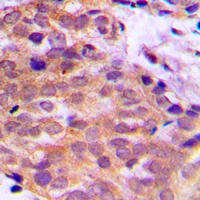 Anti-14-3-3 theta/tau Antibody
