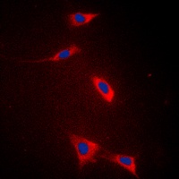 FATP5 antibody