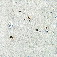 Anti-ATF7 Antibody