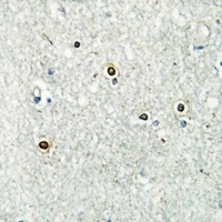 ATF7 antibody