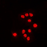 ATF7 antibody