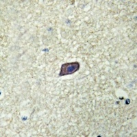 Anti-AKAP10 Antibody