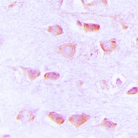 Histamine H3 Receptor Antibody