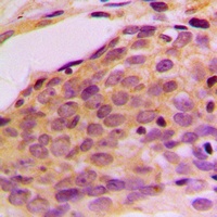 Anti-p116 Rip Antibody