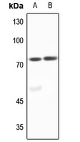 ACSL6 Antibody