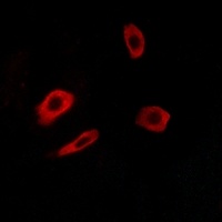 Anti-EDG7 Antibody
