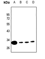 CLIC4 Antibody [KO/KD Validated]